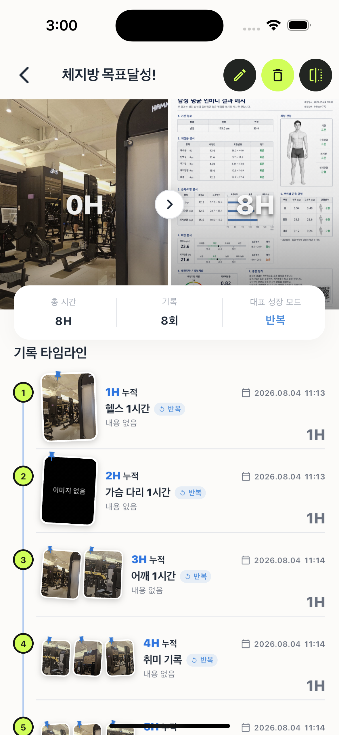 Brand:I 에픽 상세 화면
